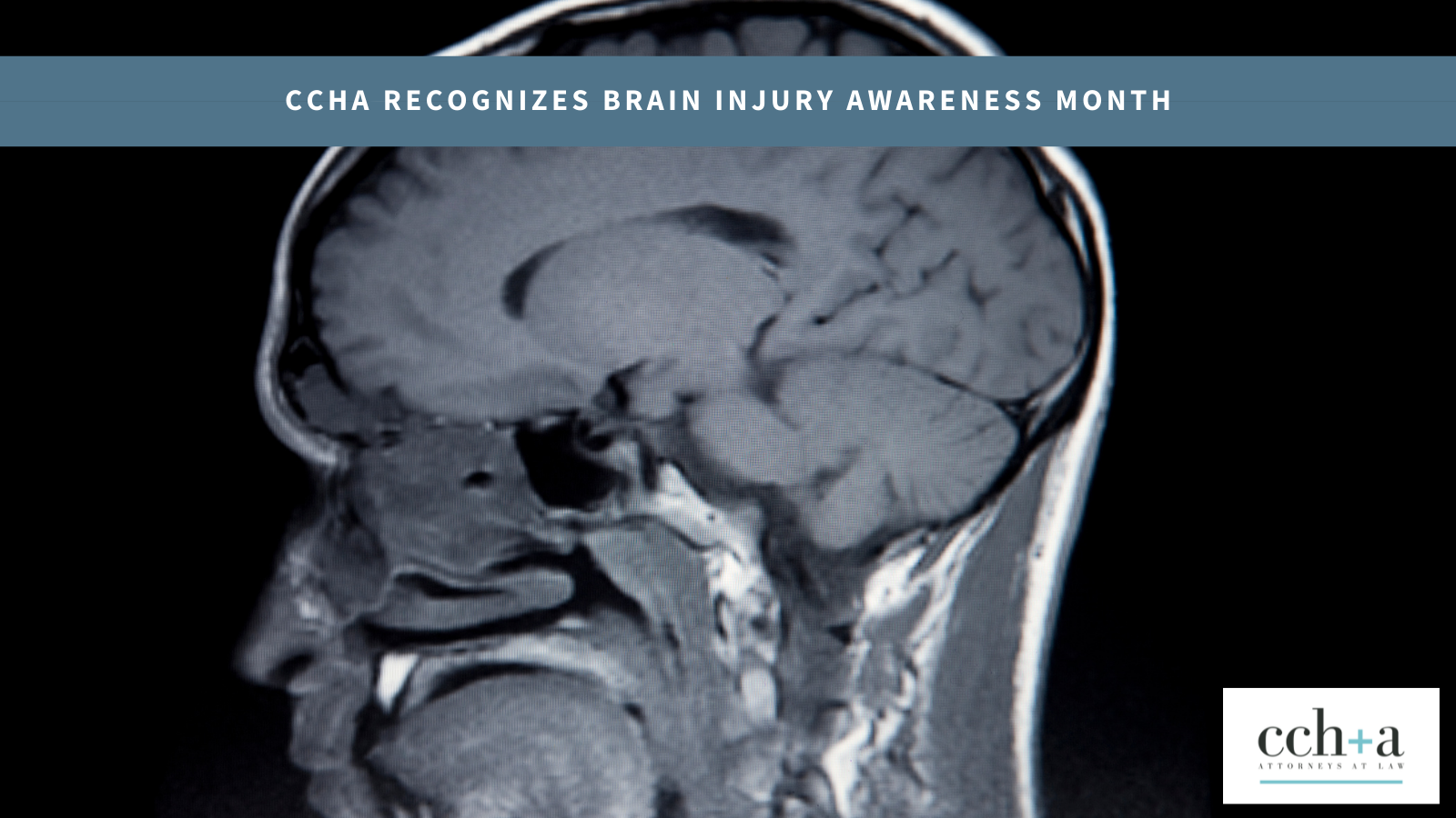 CCHA Brain Injury Awareness Month brain scan